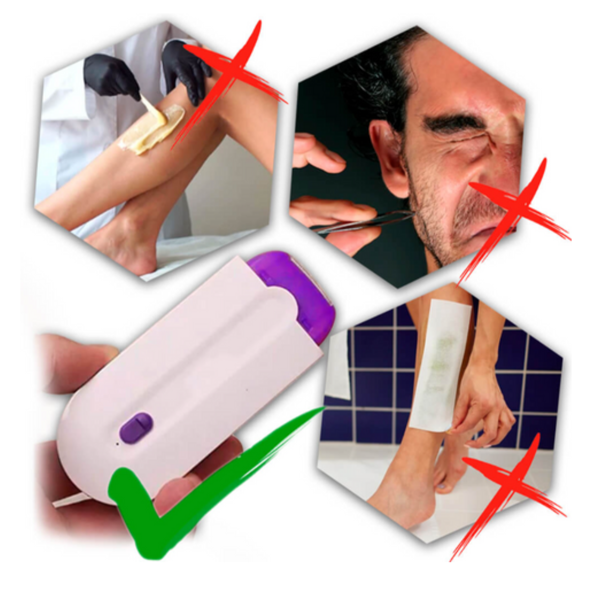 Máquina de depilación láser eléctrica